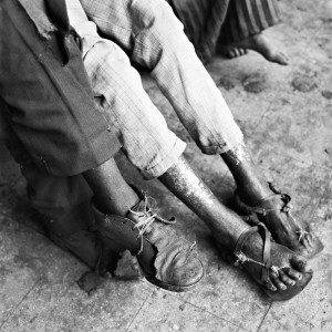 blind-people-in-afrika-4